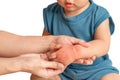 Asian baby have red swollen and blister on hand caused by insect bite, on white background Royalty Free Stock Photo