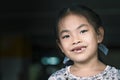 Asian child girl missing front tooth, smiling face. Close up to cute face, space for copy and design. Eyes looking at camera Royalty Free Stock Photo