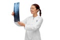 Asian female doctor looking at x-ray of spine Royalty Free Stock Photo