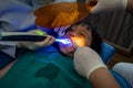 Asian girl getting dental filling treatment at molar tooth Royalty Free Stock Photo