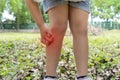 Asian girl has allergies with mosquitoes bite and itching her leg. Repellent, Royalty Free Stock Photo