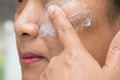 Asian lady woman applying cream skincare treatment to solve blemishes or melasma and dark spots in her face