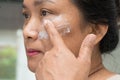 Asian lady woman applying cream skincare treatment to solve blemishes or melasma and dark spots in her face