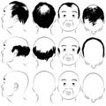 Asian Male Baldness Pattern