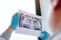 Asian male dentists are analyzing x-ray images of patients at the lab