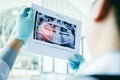 Asian male dentists are analyzing x-ray images of patients at th