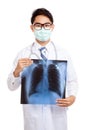 Asian male doctor wear mask with lung x-ray film