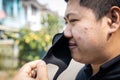 Asian man with acne on the face caused by wearing cloth face mask,bacteria from sweat,skin inflammation,young male have pimples, Royalty Free Stock Photo