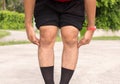 Asian man leg bandy-legged shape of the leg Royalty Free Stock Photo