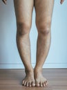 Asian man leg bandy-legged shape of the leg