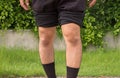 Asian man leg bandy-legged shape of the legs Royalty Free Stock Photo