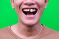 Asian man smiling showing his teeth unattractive on green background.