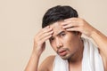 Asian man worry have blemish on face caused by acne Royalty Free Stock Photo