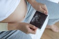 Asian pregnant woman holding ultrasound film scan of baby