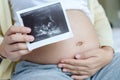 Asian pregnant woman holding ultrasound film scan of baby Royalty Free Stock Photo