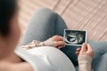 Asian pregnant woman holding ultrasound scan image, Expectation of a child and Maternity prenatal care and woman pregnancy concept Royalty Free Stock Photo