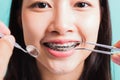 Woman smile have dental braces on teeth laughing and have medical equipment tools for check tooth Royalty Free Stock Photo