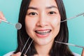 Woman smile have dental braces on teeth laughing and have medical equipment tools for check tooth Royalty Free Stock Photo