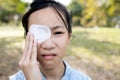 Asian teenage girl cover with blindfolded bandaged eye to protect against dust after surgery from hordeolumstye infection or