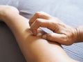 Young Thai women use hand scratching on burred of leg with itching from skin disease or insect bite Royalty Free Stock Photo