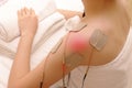 Asian woman is doing massage of electrical -stimulation ( TENs ) Royalty Free Stock Photo