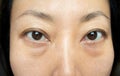 Asian woman have facial wrinkles, large bags under their eyes. Royalty Free Stock Photo