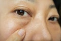 Asian woman have facial wrinkles, large bags under their eyes. Royalty Free Stock Photo