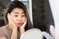 Asian woman having problem with eyes bags , dark circles, wrinkle and crow`s feet on her face skin
