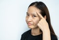 Asian woman pointing to acne problems inflamed on her forehead. Royalty Free Stock Photo