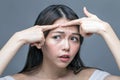 Asian woman squeezing spot on forehead Royalty Free Stock Photo