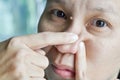 Asian woman try to squeeze nose acne pimples