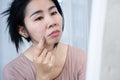 Asian woman worries about her face aging on a mirror with winkle skin nasolabial fold, smile lines, or laugh lines Royalty Free Stock Photo