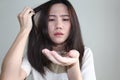 Asian women looking hair loss falling in her hand Royalty Free Stock Photo