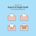 Aspect of single tooth illustration vector on blue background. D Royalty Free Stock Photo