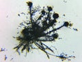 Aspergillus flavus conidia under the microcope