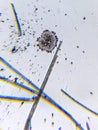 Aspergillus niger conidia and sporea under the microscope