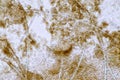 Aspergillus niger and Aspergillus oryzae mold under microscope.