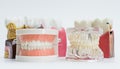 Assorted Dental Education Models with Dentures and Implants Royalty Free Stock Photo