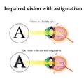 Astigmatism. As the eye can see with astigmatism. Impaired vision Royalty Free Stock Photo