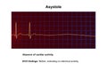 ECG in asystole, 3D illustration