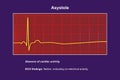 ECG in asystole, 3D illustration