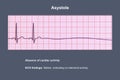 ECG in asystole, 3D illustration