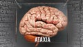 Ataxia in human brain Royalty Free Stock Photo