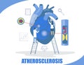 Atherosclerosis concept vector flat style design illustration