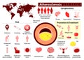 Atherosclerosis