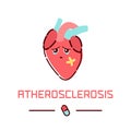 Atherosclerosis heart disease Royalty Free Stock Photo