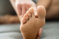 Athlete Foot Fungal Infection