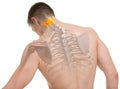 Atlas C1, C2 Spine Anatomy isolated on white