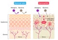 Atopic dermatitis eczema and normal skin cell illustration. Healthy skin care concept