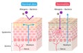 Atopic dermatitis eczema and normal skin cell layer illustration. Healthy skin care concept